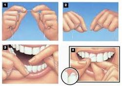 Cách dùng chỉ nha khoa để vệ sinh răng miệng