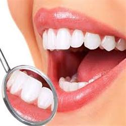Cách chăm sóc răng sau khi bọc sứ chuẩn nhất